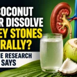 Medical-themed thumbnail showing kidneys with kidney stones, a glass of coconut water, fresh coconut, and the headline discussing whether coconut water can dissolve kidney stones naturally.